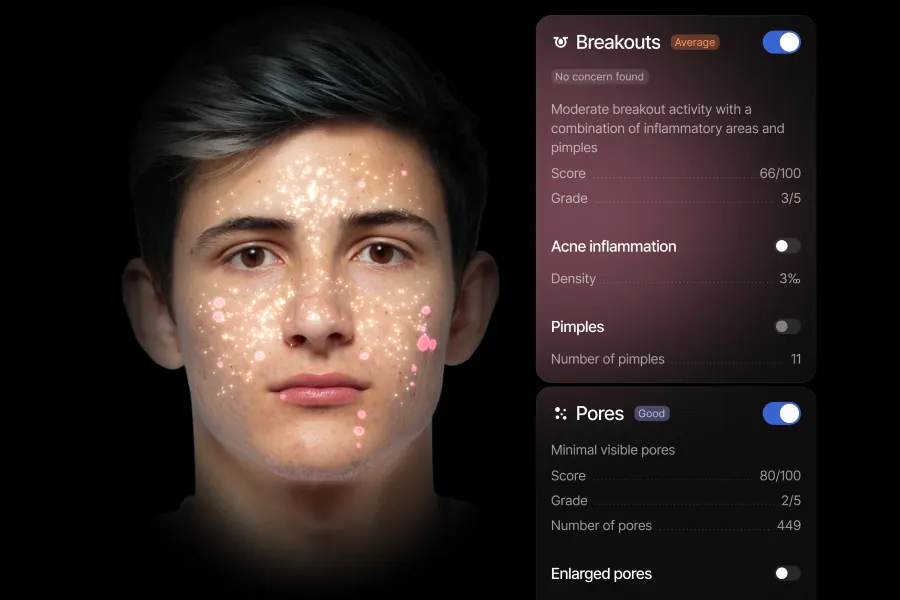 A young man's face on the right and the left gives insights about his skin.